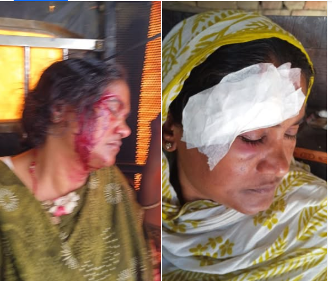 मिटर ब्याजी साहु  सुदखोरले  पिडित   सामसुङ निशा  माथि कुटपिट